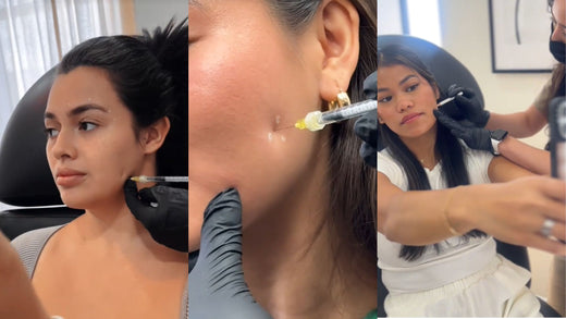 Masseter Reduction Injections by NakedMD